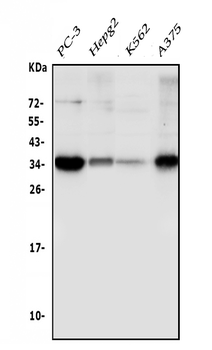 Sprouty 4/Spry-4/SPRY4 Rabbit Polyclonal Antibody