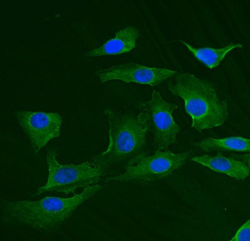 TRIM25/EFP Rabbit Polyclonal Antibody