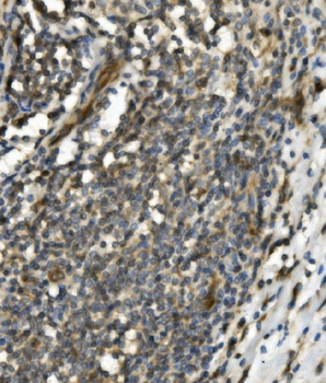 TRIM25/EFP Rabbit Polyclonal Antibody