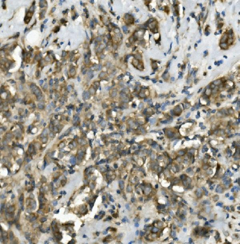 TRIM25/EFP Rabbit Polyclonal Antibody