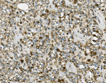 TRIM25/EFP Rabbit Polyclonal Antibody