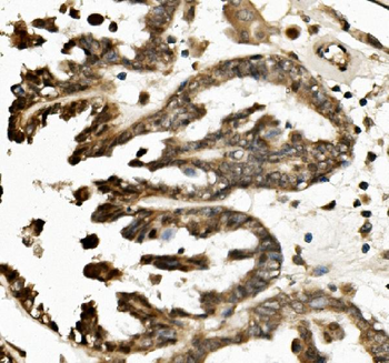 TXNIP Rabbit Polyclonal Antibody