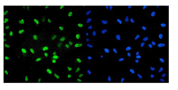 U2AF65/U2AF2 Antibody