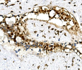 U2AF65/U2AF2 Antibody