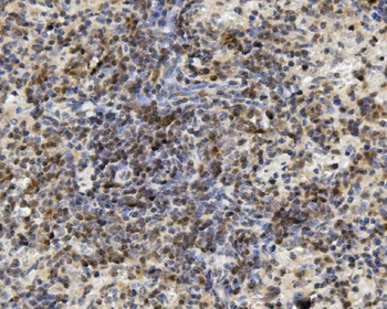 U2AF65/U2AF2 Antibody