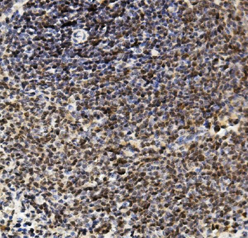 U2AF65/U2AF2 Antibody