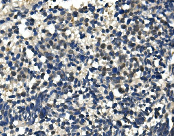 ULK1 Antibody