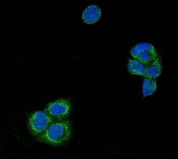 USP21 Rabbit Polyclonal Antibody