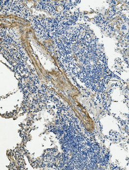 Vinculin/VCL Antibody