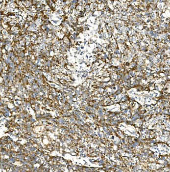 VPS4A Rabbit Polyclonal Antibody