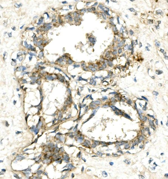 VPS4A Rabbit Polyclonal Antibody