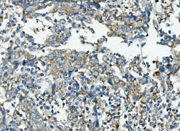 VPS4B/MIG1 Rabbit Polyclonal Antibody