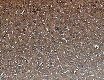 PP2A-alpha/PPP2CA Antibody (monoclonal, 3B6)