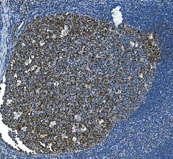 MCM2 Mouse Monoclonal Antibody