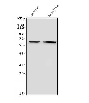 GAD65/GAD2 Antibody (monoclonal, 7G2)