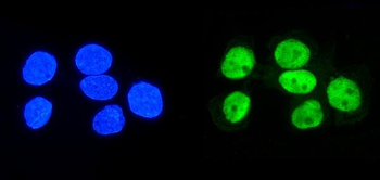 hnRNP D/AUF1/HNRNPD Mouse Monoclonal Antibody