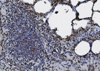 hnRNP D/AUF1/HNRNPD Mouse Monoclonal Antibody