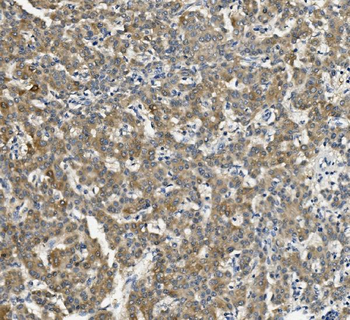 Cytochrome p450 2C19/CYP2C19 Mouse Monoclonal Antibody