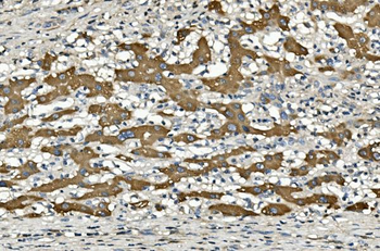 Cytochrome p450 2C19/CYP2C19 Mouse Monoclonal Antibody