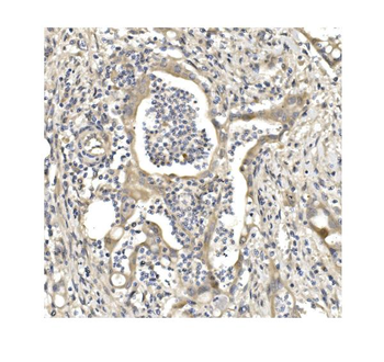 Aconitase 1/ACO1 Antibody