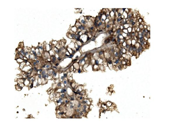 Aconitase 1/ACO1 Antibody