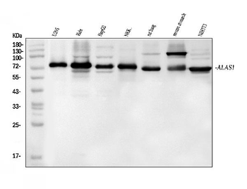 Alas1 Rabbit Polyclonal Antibody