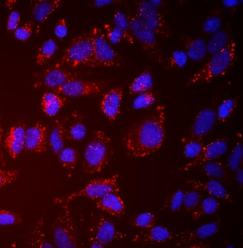 NDP52/CALCOCO2 Rabbit Polyclonal Antibody