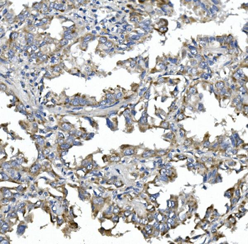 NDP52/CALCOCO2 Rabbit Polyclonal Antibody
