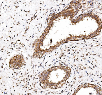 NDP52/CALCOCO2 Rabbit Polyclonal Antibody