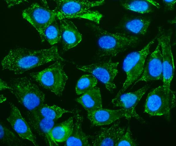 Caveolin-2/CAV2 Antibody