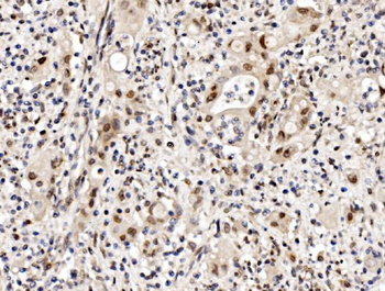 Cbx8 Antibody