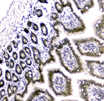 Cbx8 Antibody