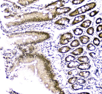 Cbx8 Antibody