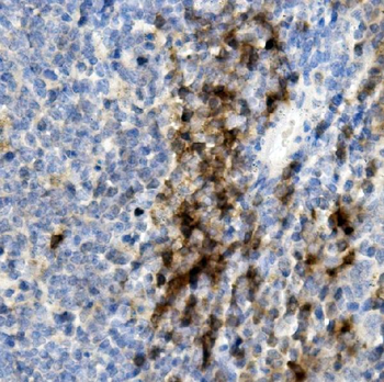 CD8 alpha/Cd8a Rabbit Polyclonal Antibody