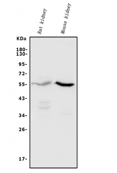 CYP11B1/C11B2/CYP11B2 Rabbit Polyclonal Antibody