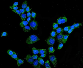 CYP27A1 Rabbit Polyclonal Antibody