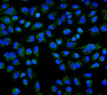 DLL1 Rabbit Polyclonal Antibody