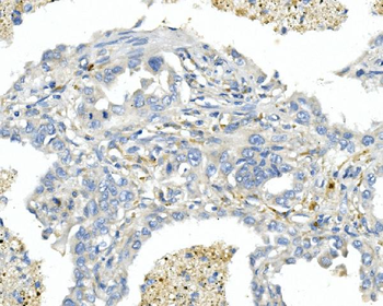 Endothelin A Receptor/ET-A/EDNRA/ET Rabbit Polyclonal Antibody
