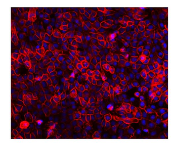 EGFR Antibody