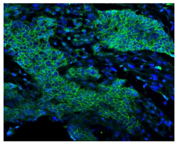 EGFR Antibody