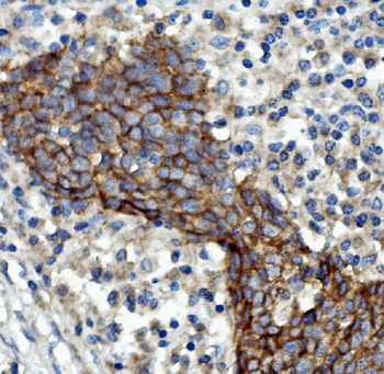 EGFR Antibody