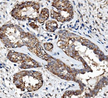 EGFR Antibody