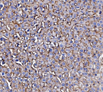EGFR Antibody