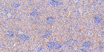 Glutaminase/GLS Antibody