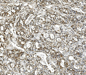 Glutaminase/GLS Antibody