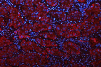 Glutaminase/GLS Antibody