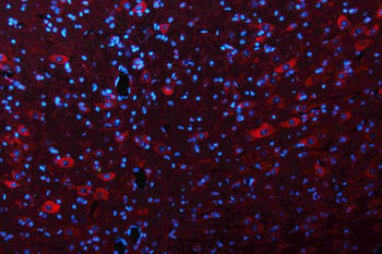 Glutaminase/GLS Antibody