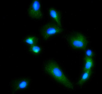Glutaminase/GLS Antibody