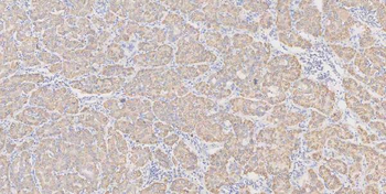 Glutaminase/GLS Antibody