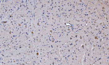 Glutaminase/GLS Antibody